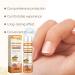 Bee Venom Nail Fungus Soothing Spray - Extra Strength Toenail Treatment (20ml) | Natural Nail Fungus Relief - Buy Online on GoSupps.com