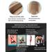 Level 2 Compression Medical Knee Pads with Patella Gel Support - Joint Pain Relief Sleeves for Working Out - Large 1 Pair Beige - International Shipping Available - Buy Online on GoSupps.com