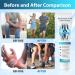Arthroheal Hyaluronic Acid Joint Repair Cream 2 Packs Hyaluronic Joint Creams Arthroheal Cr me R paratrice Pour L'acide Hyaluronique pour le Dos le Cou les Mains les Genoux 50g - Buy Online on GoSupps.com