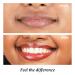 Brightening Lip Balm for Dark Lips | Brightens Pigmented Lips | Hydrates Lips | Lip Balm - Ruby Glaze 12gm - Buy Online on GoSupps.com