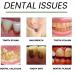 Brightening Toothpaste for Stain Removal | Refreshing Breath & Sensitive Teeth | Daily Oral Care for Adults | Biological Formula - Buy Online on GoSupps.com