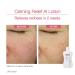 Physiogel Calming Relief A.I. Face Lotion | Soothes Sensitive, Eczema-Prone Skin | Hypoallergenic Formula, 6.7 fl. Oz - Buy Online on GoSupps.com