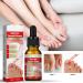 Ingrown Toenail Treatment Nail Growth Ingrowing Toenail Treatment Nail Helper Fungal Nail Treatment Correction Oil Drops Ingrown Toenail Corrector Toe Nail Fungus Treatment Cuticle Oil - Buy Online on GoSupps.com