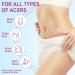 Silicone Scar Sheets & Tape Roll for Effective Scar Removal | Waterproof & Reusable Soft Silicone - 1.6x75 (1.9M) - Buy Online Now - Buy Online on GoSupps.com