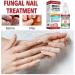 Extra Strong Fungal Nail Treatment - Repair, Strengthen, and Renew Damaged Toenails and Fingernails - Buy Online on GoSupps.com