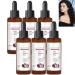 yikaiszh Rosemary Hair Serum - Vitamin E Scalp Care Oil - Anti-Dryness Growth Serum - More Powerful - Thinning Essence - Repair for Shiny Hair - For All