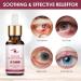 Stye Eye Treatment Chalazion Remover - Fast Relief Serum for Eye Irritation and Eyelid Relief - Buy Online on GoSupps.com