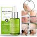 Goopgen Advanced Scar Repair Serum - Medical Grade Nature Treatment for All Types of Scars (Color 5pc) - Buy Online on GoSupps.com