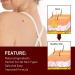 Wipe Off Tags and Mole Remover Skin Tag Remover & Mole Remover for Face Armpit Flesh Neck - Buy Online on GoSupps.com