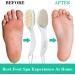 Buy 2 in 1 Foot Pumice Stone Brush - Exfoliator & Scrubber for Dead Skin & Callus Remover | International Shipping Available - Buy Online on GoSupps.com