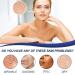 Retinol Face Cream Collagen Cream Retinol Moisturizer for Face with Hyaluronic Acid Vitamin E and Green Tea Day and Night Cream for Lifting Skin Wrinkles Fine Lines and Dryness - Buy Online on GoSupps.com