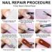 Wcybym 5G Broken Nail Repair Kit with Glue Gel Strengthener Manicure Restoration Kit Split Nail Health Pack Long Lasting Adhesion for Sealing Fragilized Ends - Buy Online on GoSupps.com