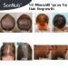 Buy 5% Minoxidil Hair Growth Spray - Effective Hair Regrowth Treatment for Men & Women | Thicker Stronger Hair | 1 Month Supply (60mL - Buy Online on GoSupps.com