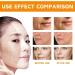 Turmeric Face Cream - Face Moisturizer for Women - Face Moisturiser with Turmeric & Vitamin C - Natural Skincare Ingredient - Anti-Aging Moisturiser Face Women - Dark Spot Remover Face Cream for Women - Buy Online on GoSupps.com