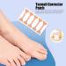Toenail Corrector Patch Breathable 20 Sheets Aerodynamic Ingrown Toenail Corrector Patch for Daily Life - Buy Online on GoSupps.com