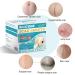 Medical Grade Silicone Scar Sheets - Reusable Scar Tape for C-Section, Surgery, Burn, Keloid - 1.6x120 - Buy Online on GoSupps.com