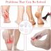 20 Pieces High Heel Protection Pads | Silicone Anti-Slip Cushions for Women & Men | Friction Bubble Prevention - Buy Online on GoSupps.com