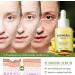  SKZKK Turmeric Milk Serum - Turmeric Facial Serum - Brightening Serum to Correct Dark Spots - Vitamin C Serum - Turmeric Facial Oil - Anti-Aging Moisturizing Serum (6 - Buy Online on GoSupps.com