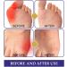 10pcs Herbal Extract Bunion Relief Patches for Men and Women - Foot Care Pain Relief for Bunion Swelling and Soreness - Buy Online on GoSupps.com