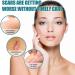 Teksome Scar Tape for Body - 1.5m Stretch Mark Remover Strips | Silicone Gel Tape for Scars & Stretch Marks - Buy Online on GoSupps.com