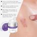  Generisch Scar Cream 50g Bleaching Cream Repair Cream for Spots Wounds Caesarean Sections Old Scars Burns Legs - Buy Online on GoSupps.com