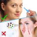 10 Pack Hard Contact Lens Remover Tool - Suction Cup for RGP & Scleral Lenses (Blue) | International Shipping Available - Buy Online on GoSupps.com