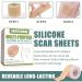 Professional Silicone Scar Sheets Roll - 1.6 X 60 Inch - Soft Gel for Scars - Surgical, C-Section, Keloid, Acne - Effective Scar Removal Treatment - Buy Online on GoSupps.com
