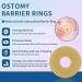 Ostomy Barrier Rings for Better Seal | 24mm Outer Diameter & 2mm Thickness | Box of 10 - Buy Online on GoSupps.com
