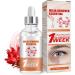 Milia S rum d maquillant pour le contour des yeux S rum facial contre les miliums et les taches brunes pour homme et femme r duit le rel chement de la peau les gonflements et les ridules 30 ml 1 pi ce.