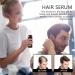 Youding Hair Sealing Oil - He Shou Wu Essential Oil | 100ml Anti-Thinning Deep Strengthening & Moisturizing Oil for All Hair Types | Hair Growth Solution - Buy Online on GoSupps.com