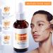Whitening Niacinamide Serum - Face Serum for Women - Hyaluronic Acid Serum for Face - Skin Care for Dark Spot Correcting Glow Serum - Face Serum for Anti-Ageing and Wrinkles (30ml) - Buy Online on GoSupps.com