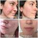 Science of Skin Rescue No. One - Ultimate Treatment for Spots Blemishes & Acne Scars | International Shipping Available - Buy Online on GoSupps.com