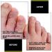 FungusLess Nail and Foot Purifier - Purify Protect and Rejuvenate Your Feet - Prevent Bacteria Athlete's Foot and Fungus - Buy Online on GoSupps.com