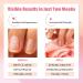 EJW Nail Strengthener Serum - Boost Nail Growth & Repair Weak Nails | Licorice Root Jojoba Oil Hyaluronic Acid (1.01 fl oz - Buy Online on GoSupps.com