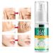 50ml Scar Removal Cream for Old & New Scars - Stretch Marks, Burn & Surgical Cesarean Scar Treatment - Buy Online on GoSupps.com