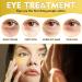 24K Gold Under Eye Masks - Hydrating Eye Patches for Dark Circles & Puffiness Relief | Collagen & Amino Acid Treatment for Men & Women | Skin Care Essentials - Buy Online on GoSupps.com