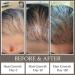 Huile anti-pelliculage pour des cheveux sains - Avec 14 herbes ayurv diques de l'Himalaya et du romarin - Buy Online on GoSupps.com