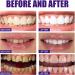 Colour Corrector Toothpaste for Effective Tooth Stain Removal | Purple Toothpaste for Vibrant Smiles - Shop Now - Buy Online on GoSupps.com