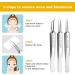 3-Piece Stainless Steel Pimple Tweezers Set | Blackhead Remover & Comedone Squeezer | Unisex Pimple Removal Tools for Nose & Face - Buy Online on GoSupps.com