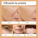  WJnflQN Firming Eye Cream 15g Natural Eye Contour Cream - Natural Facial Moisturizer for Day and Night Makeup Wearers Mothers Daughters Women - Buy Online on GoSupps.com