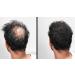 LUXE Hair Thickening Fibers - Hypoallergenic, Dermatologist Tested - 2 Months+ Supply in Dark Brown - Buy Online on GoSupps.com