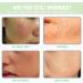 Panthenol Face Serum Niacinamide Serum Brightening Serum Hydrating Serum Korean Serum For Repair Dark Spot Corrector For Face Calming Serum Green Tea+Hyaluronic Acid Panthenol Cream - Buy Online on GoSupps.com