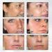 Dark Spot Remover for Face -Age Spot Remover -Hyperpigmentation Treatment-Sun Spots and Melasma Treatment Cream for Face Pigmentation Freckle Removal Cream - Buy Online on GoSupps.com