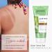 Neutriherbs Aloe Vera Gel - Pure Aloe Vera Juice with Vitamins A C E for Sunburns Acne Dry Skin & Itch Relief - 6.7 Fl Oz - Buy Online on GoSupps.com