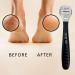 FACN Professional Pedicure Callus Shaver Remover - 50 Blades Included - Surgical Grade Stainless Steel - Salon Quality Tool for Removing Calluses, Corns & Rough Skin - Buy Online on GoSupps.com