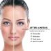 Elitzia ETBDF30 Carbon Peel Gel Skin Rejuvenation Cream 300ML - Deep Cleaning & Facial Skin Rejuvenation - Buy Online on GoSupps.com