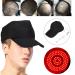 118PCS Light Beads Hairwell Hutkap - Oil Control Hair Therapy for Men & Women | Anti-Baldness Treatment - Buy Online on GoSupps.com