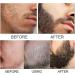 2pcs Huile de Croissance pour la Barbe Huile Barbe Naturelle Kit D' paississement de la Barbe Nourrissant et paississant pour la Barbe 2pcs*60ml hair1 - Buy Online on GoSupps.com