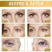 Snail Peptide Energetic Eye Roll-On Hydrating Snail Peptide Eye Cream Firming Eye Cream Hydrating Snail Eye Cream Under Eye Roller cream Eye Cream for Dark Circles and Puffy Eyes Eye Cream Anti-aging - Buy Online on GoSupps.com