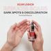 Scar Logic Advanced Treatment Cream for Face & Body | Scar Remover for Acne, Surgical, Stretch Mark & Burn Scars | Nourishing Biologicals (20ml) - Buy Online on GoSupps.com